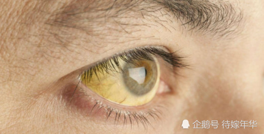 火烧眉毛,揭秘与生肖的奇妙联系 火烧眉毛,揭秘与生肖的奇妙联系