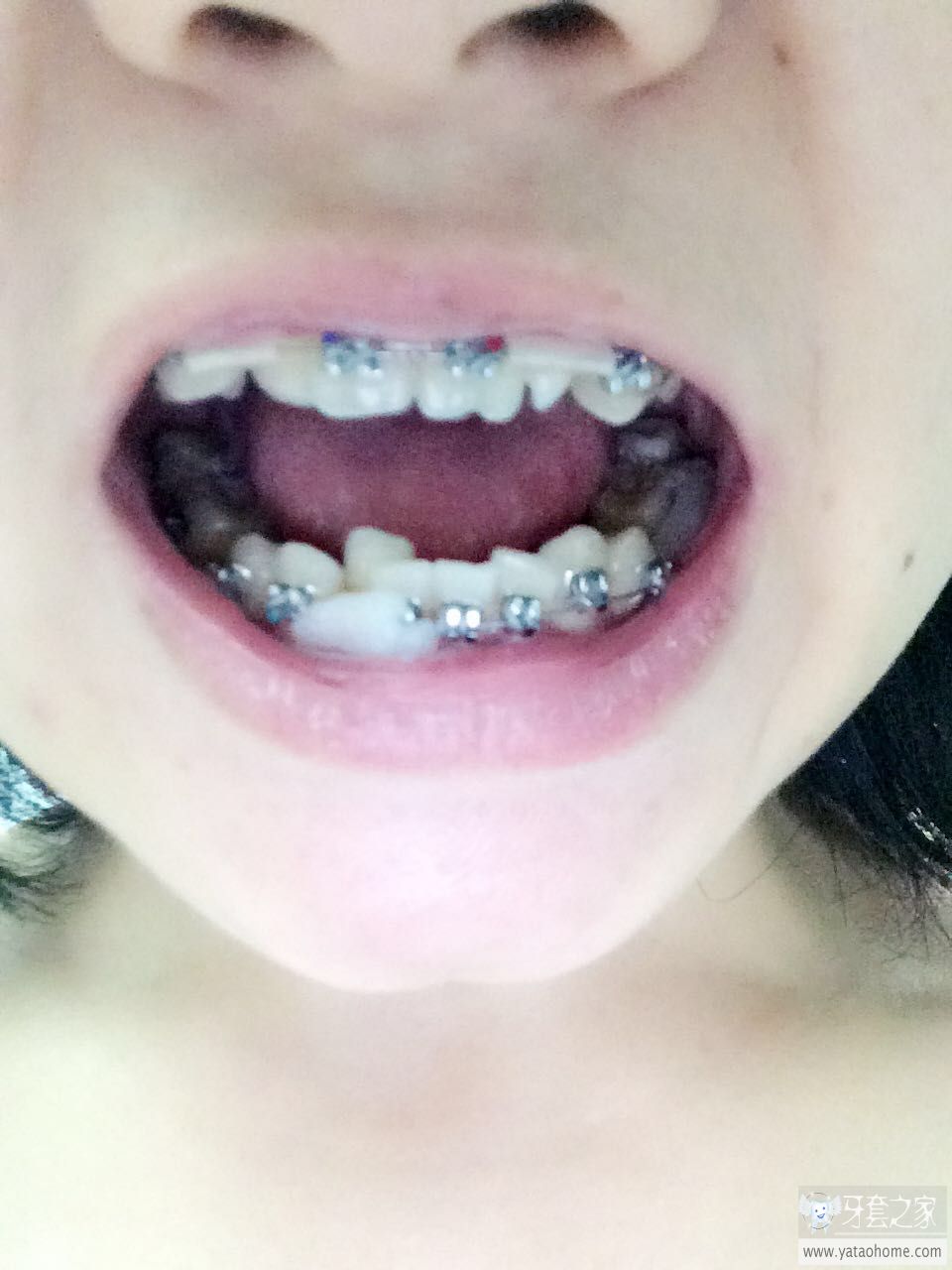 咬紧牙根,权威揭晓的生肖之谜 咬紧牙根,权威揭晓的生肖之谜