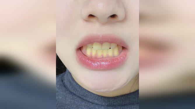 红口白牙指一正确生肖:精准解答落实 红口白牙指一正确生肖:精准解答落实